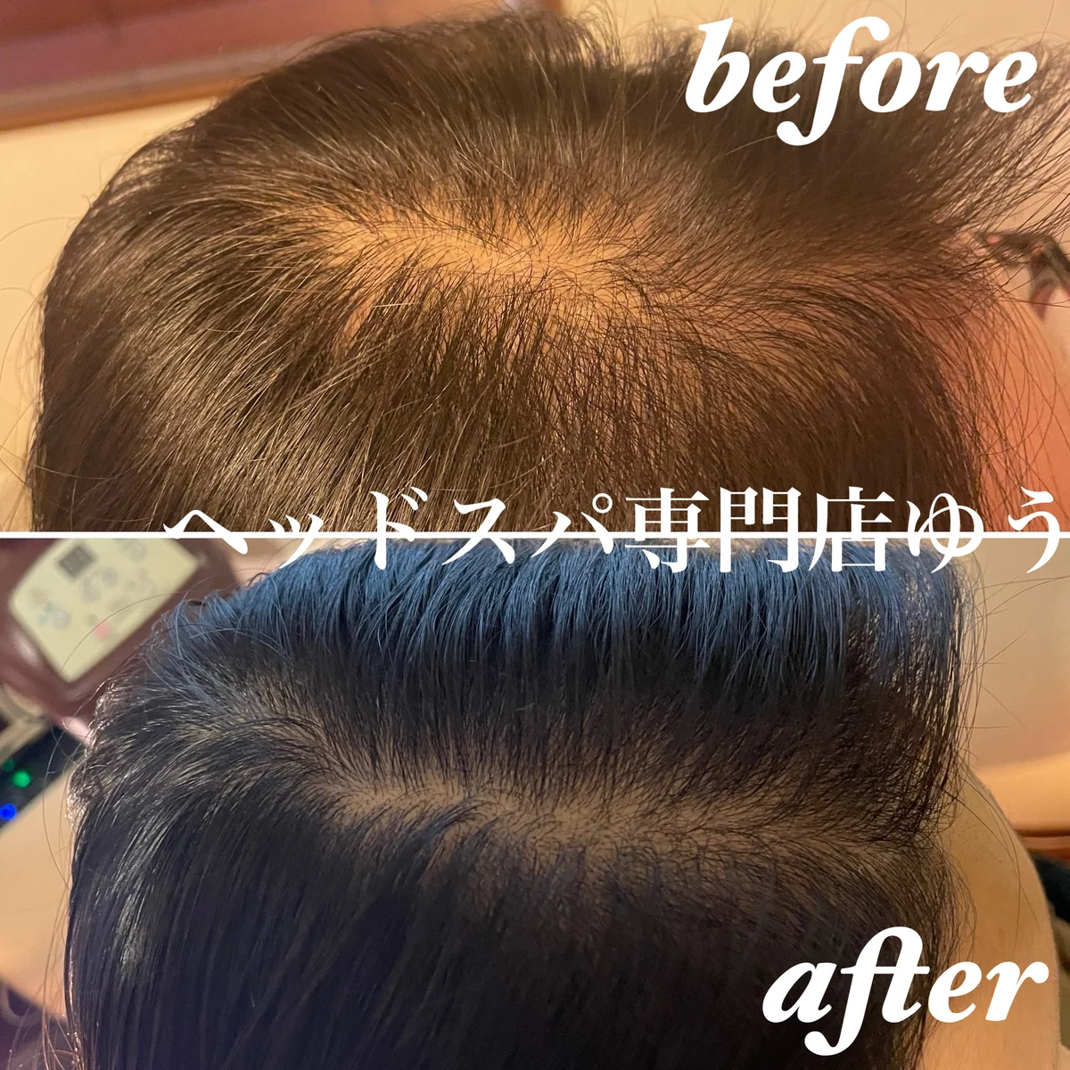 Scalp care client example 1