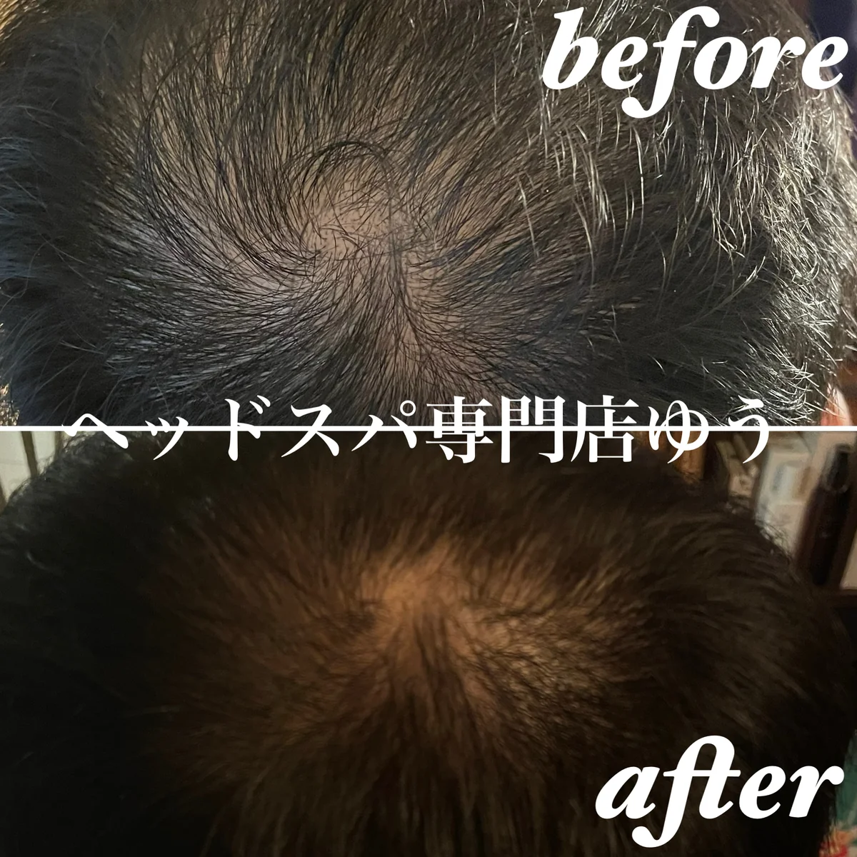 Scalp care client example 2