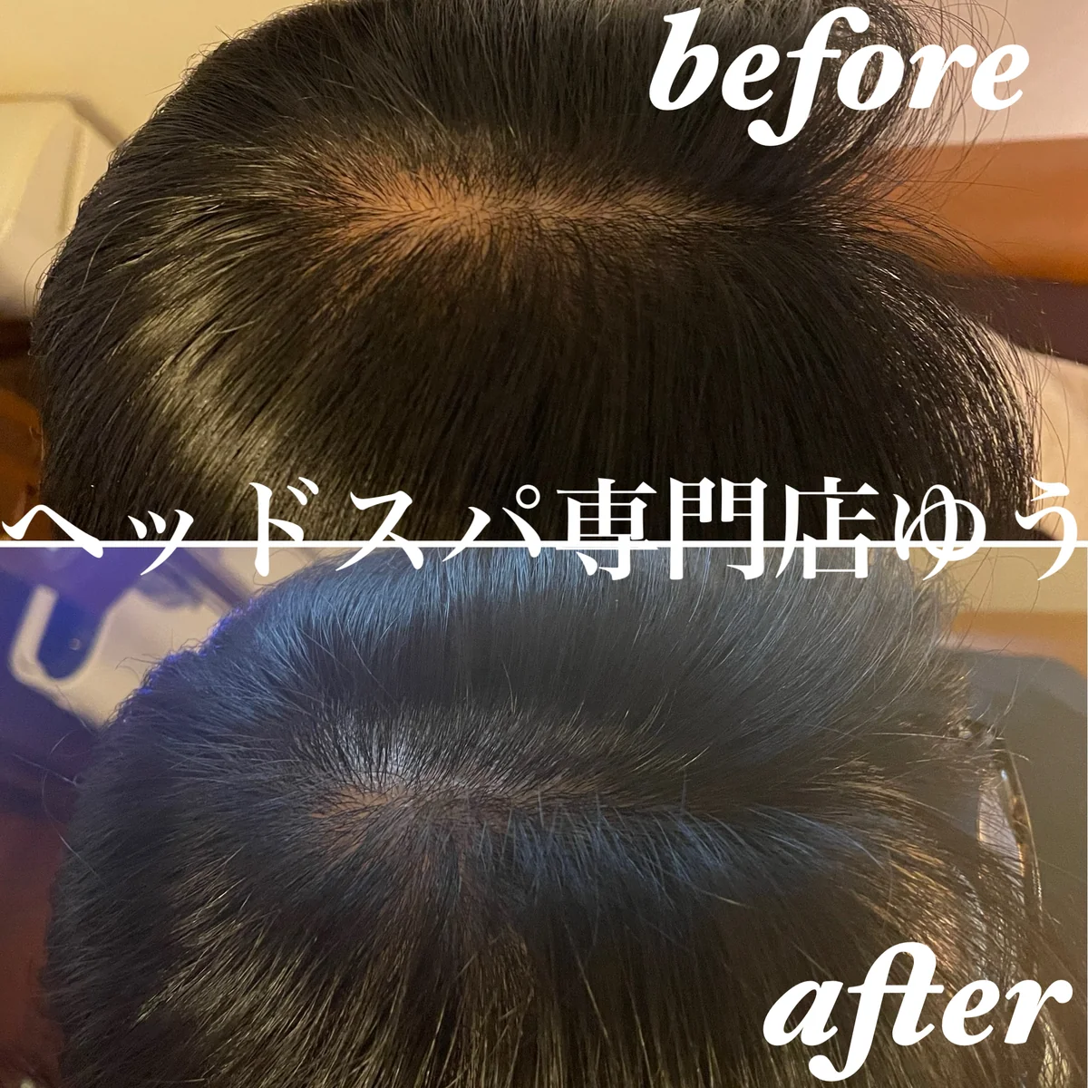 Scalp care client example 3