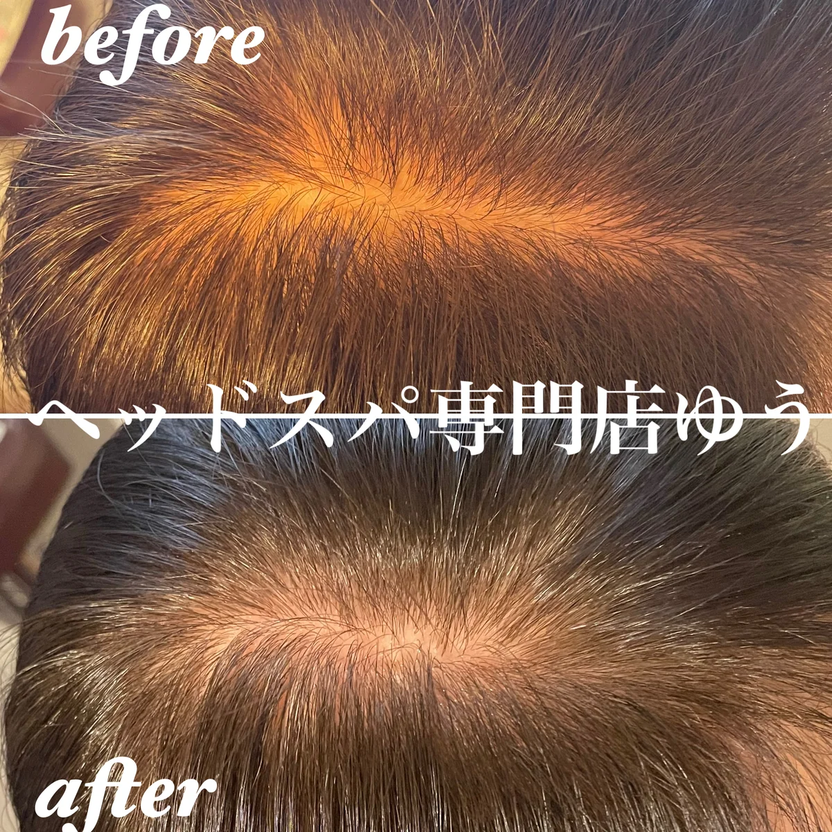 Scalp care client example 4