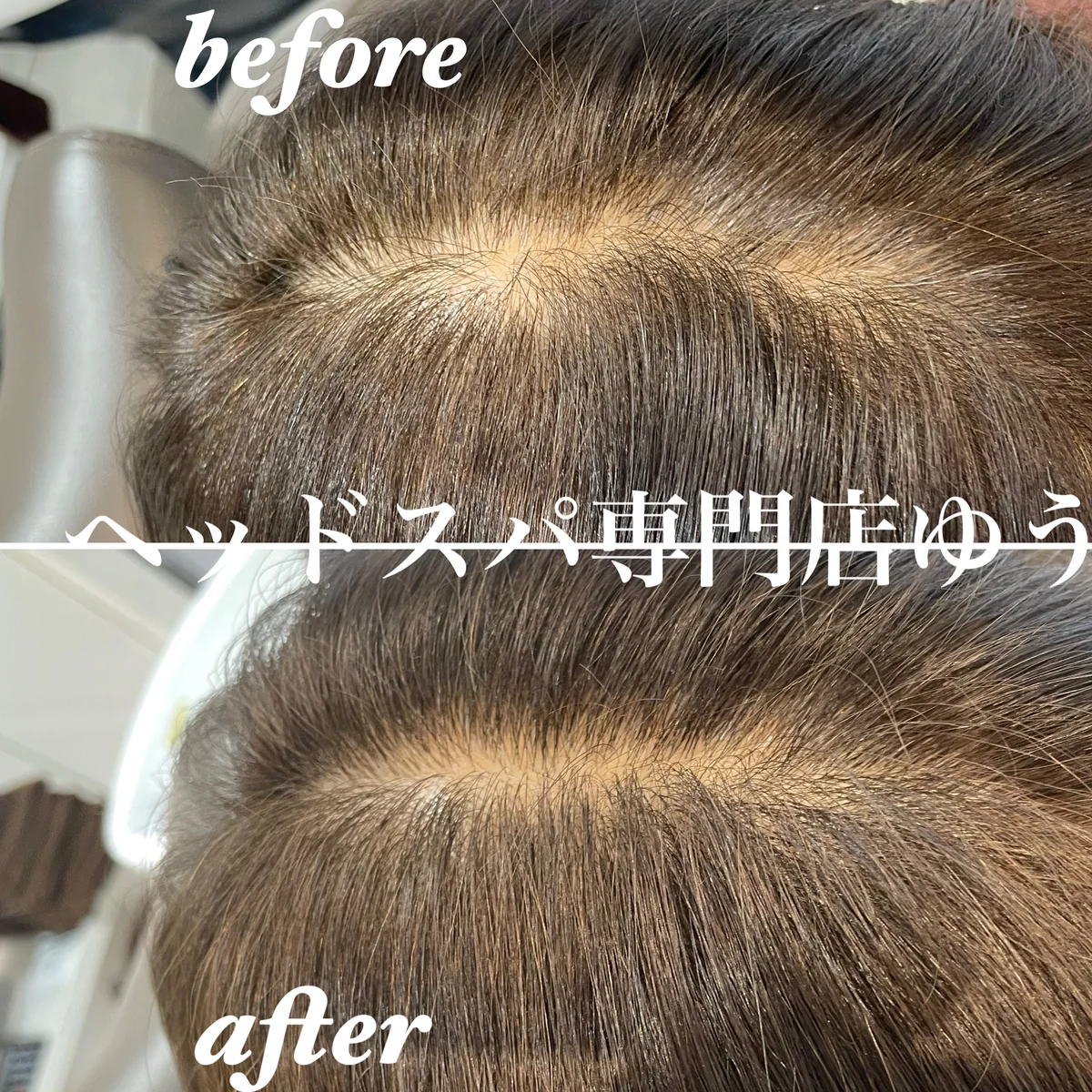 Scalp care client example 5