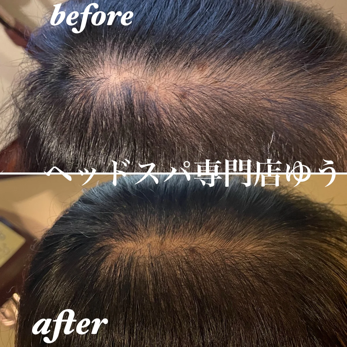 Scalp care client example 6