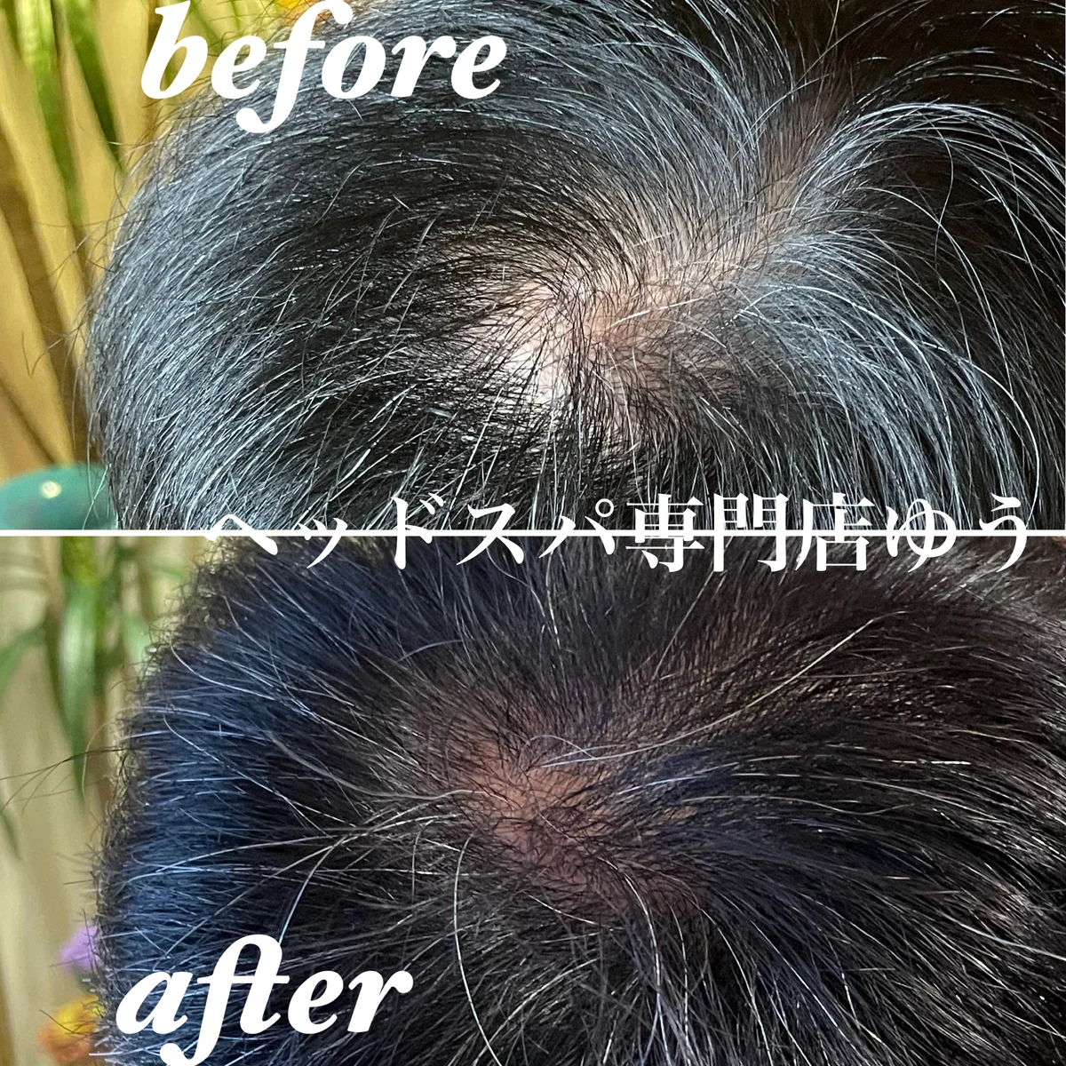 Scalp care client example 7