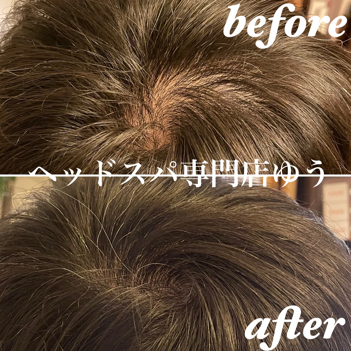 Scalp care client example 8
