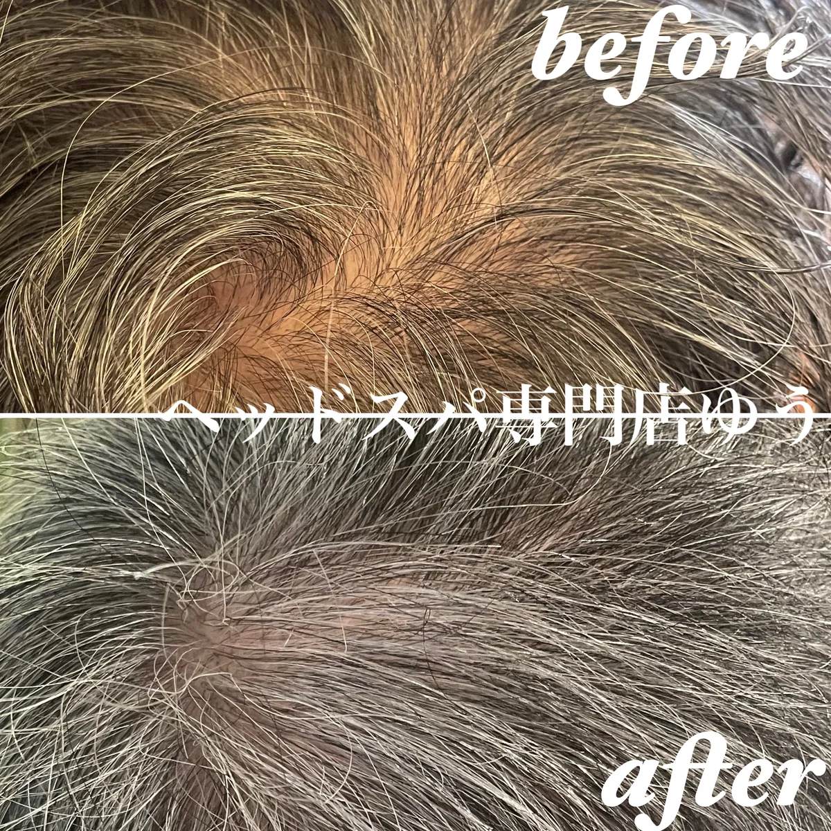 Scalp care client example 9