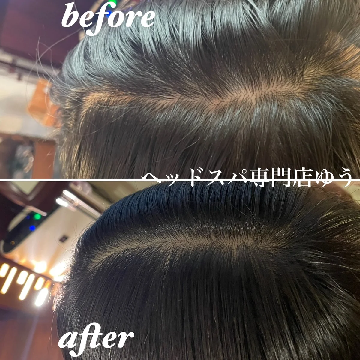 Scalp care client example 10