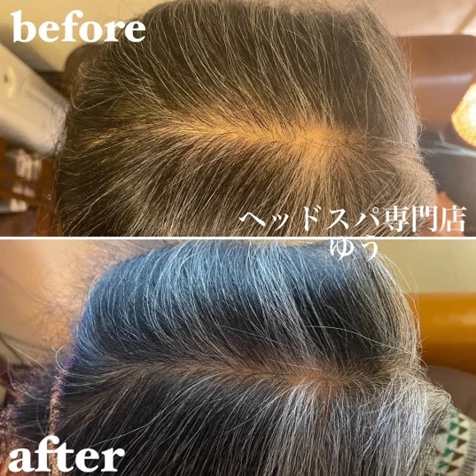 Scalp care client example 11