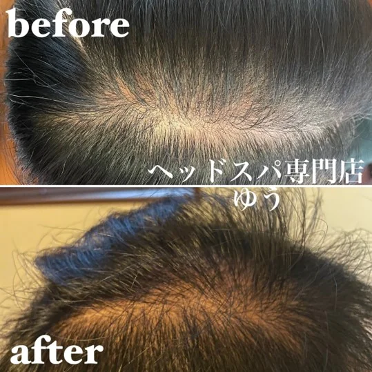 Scalp care client example 12