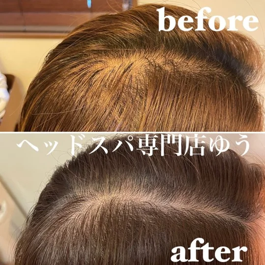 Scalp care client example 13