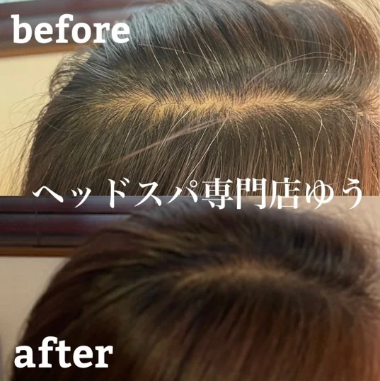 Scalp care client example 14