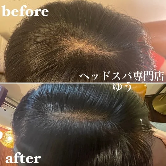Scalp care client example 15