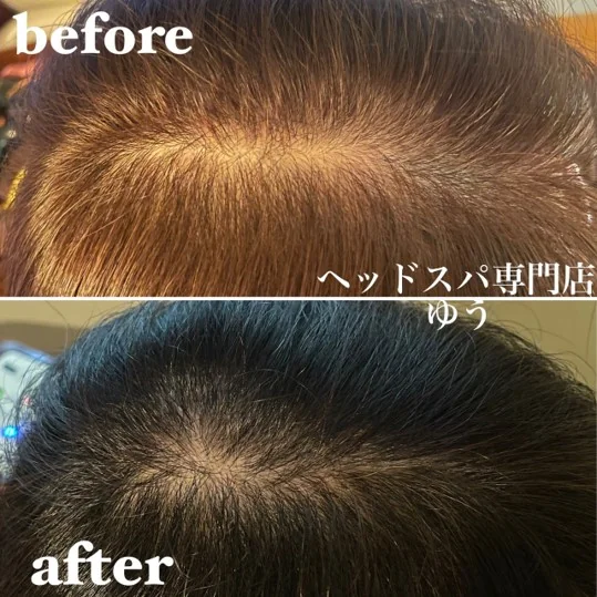 Scalp care client example 16