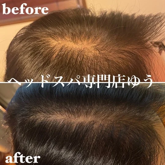 Scalp care client example 17