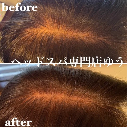Scalp care client example 18