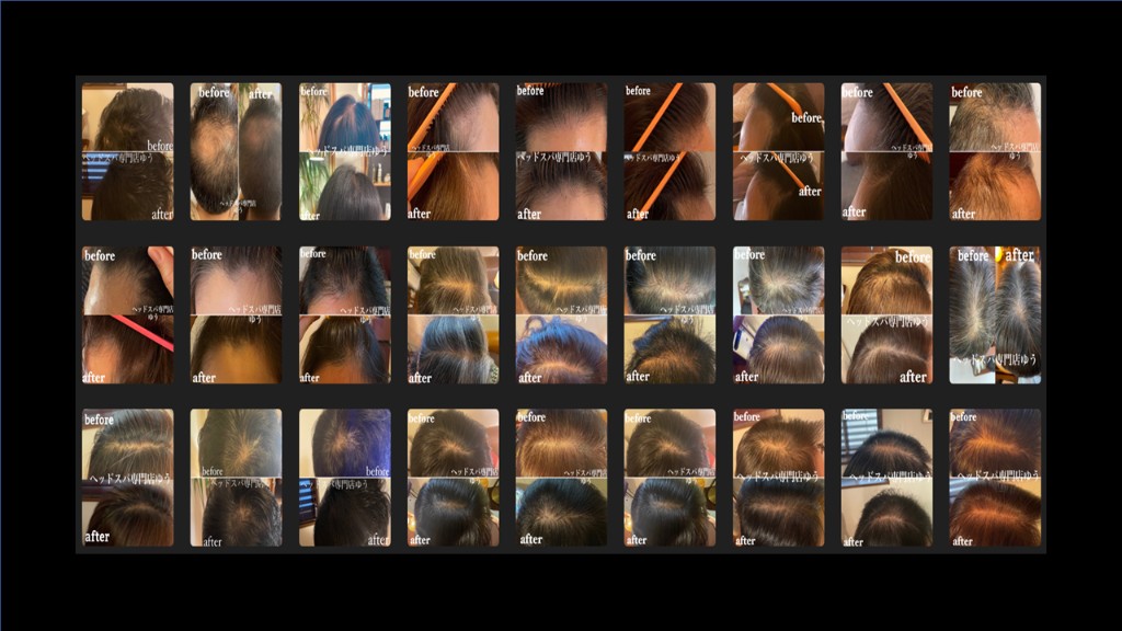 ～ヘッドスパ×育毛～